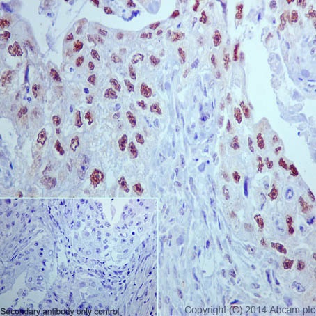 Immunohistochemistry (Formalin/PFA-fixed paraffin-embedded sections) - Anti-DRIP130 antibody [EPR17418] (AB200351), expandable thumbnail