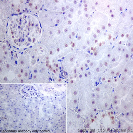 Immunohistochemistry (Formalin/PFA-fixed paraffin-embedded sections) - Anti-DRIP130 antibody [EPR17418] (ab200351), expandable thumbnail
