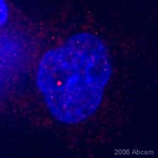 Immunocytochemistry - Anti-Drosha antibody (AB12286), expandable thumbnail
