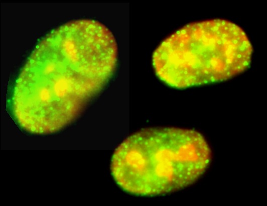 Immunocytochemistry - Anti-Drosha antibody (AB12286), expandable thumbnail