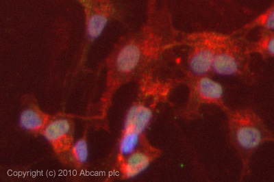 Immunocytochemistry - Anti-Drosha antibody (AB12286), expandable thumbnail