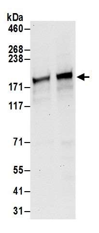 Western blot - Anti-Drosha antibody (AB245398), expandable thumbnail
