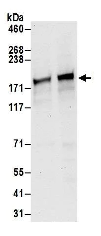 Western blot - Anti-Drosha antibody (AB245398)