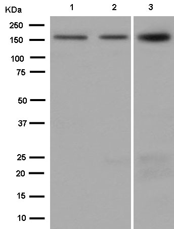 Western blot - Anti-Drosha antibody [EPR12794] (AB183732), expandable thumbnail