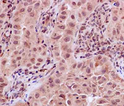 Immunohistochemistry (Formalin/PFA-fixed paraffin-embedded sections) - Anti-Drosha antibody [EPR12794] - BSA and Azide free (AB227460)