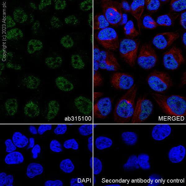 Immunocytochemistry/ Immunofluorescence - Anti-Drosha antibody [RM1063] - BSA and Azide free (AB315101)