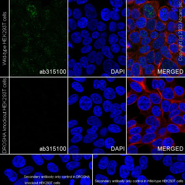Immunocytochemistry/ Immunofluorescence - Anti-Drosha antibody [RM1063] - BSA and Azide free (AB315101)