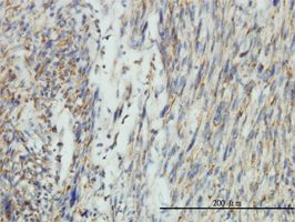 Immunohistochemistry (Formalin/PFA-fixed paraffin-embedded sections) - Anti-DRP1 antibody [3B5] (AB56788)