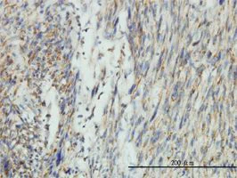 Immunohistochemistry (Formalin/PFA-fixed paraffin-embedded sections) - Anti-DRP1 antibody [3B5] (AB56788)