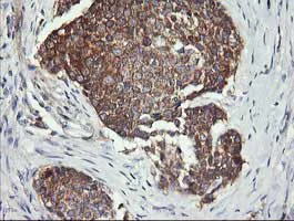 Immunohistochemistry (Formalin/PFA-fixed paraffin-embedded sections) - Anti-DRP1 antibody [OTI4F6] (AB156951)