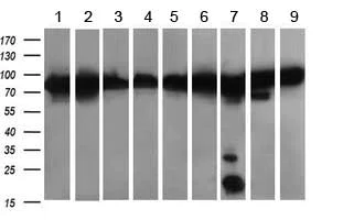 Western blot - Anti-DRP1 antibody [OTI4F6] (AB156951)