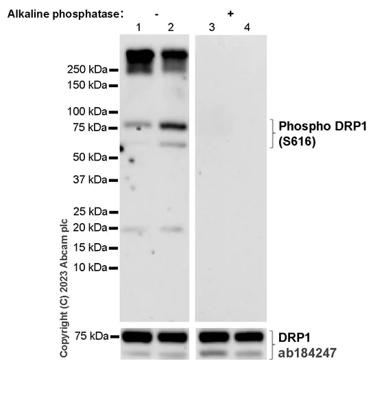 Western blot - Anti-DRP1 (phospho S616) antibody [EPR27387-57] (AB314755)
