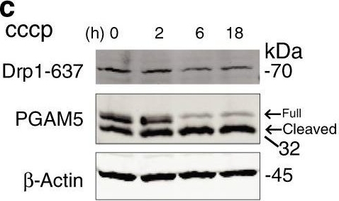 Western blot - Anti-DRP1 (phospho S637) antibody (AB193216)