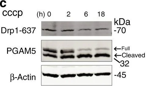 Western blot - Anti-DRP1 (phospho S637) antibody (AB193216)