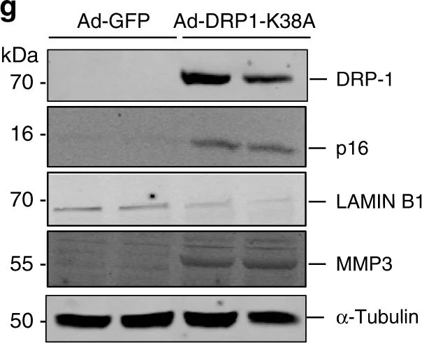 Western blot - Anti-DRP1 (phospho S637) antibody (AB193216)