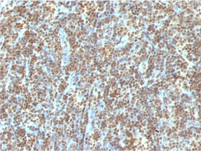 Immunohistochemistry (Formalin/PFA-fixed paraffin-embedded sections) - Anti-ds DNA antibody [121-3] (AB270732)