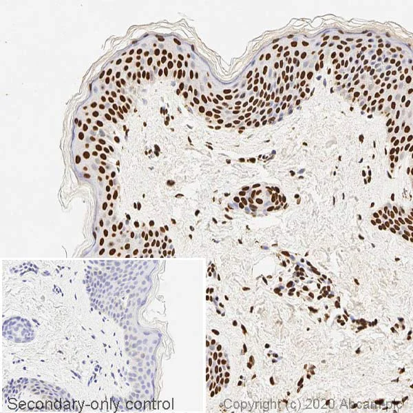 Immunohistochemistry (Formalin/PFA-fixed paraffin-embedded sections) - Anti-ds DNA antibody [35I9 DNA] - BSA and Azide free (AB27156)