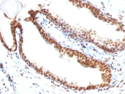 Immunohistochemistry (Formalin/PFA-fixed paraffin-embedded sections) - Anti-ds DNA antibody [DSD/958] (AB215896)
