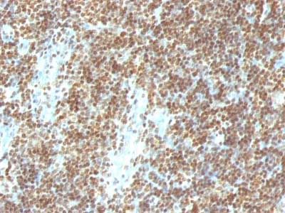 Immunohistochemistry (Formalin/PFA-fixed paraffin-embedded sections) - Anti-ds DNA antibody [DSD/958] (AB215896)