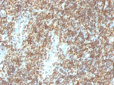 Immunohistochemistry (Formalin/PFA-fixed paraffin-embedded sections) - Anti-ds DNA antibody [DSD/958] (AB215896)