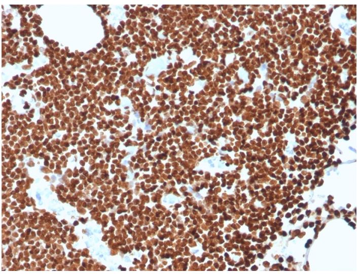 Immunohistochemistry (Formalin/PFA-fixed paraffin-embedded sections) - Anti-ds DNA antibody [rDSD/4565] - BSA and Azide free (AB273144), expandable thumbnail