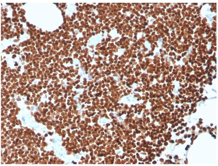 Immunohistochemistry (Formalin/PFA-fixed paraffin-embedded sections) - Anti-ds DNA antibody [rDSD/4565] - BSA and Azide free (AB273144)