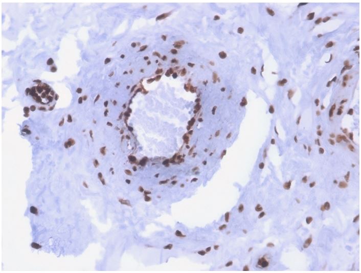 Immunohistochemistry (Formalin/PFA-fixed paraffin-embedded sections) - Anti-ds DNA antibody [rDSD/4565] - BSA and Azide free (AB273144), expandable thumbnail