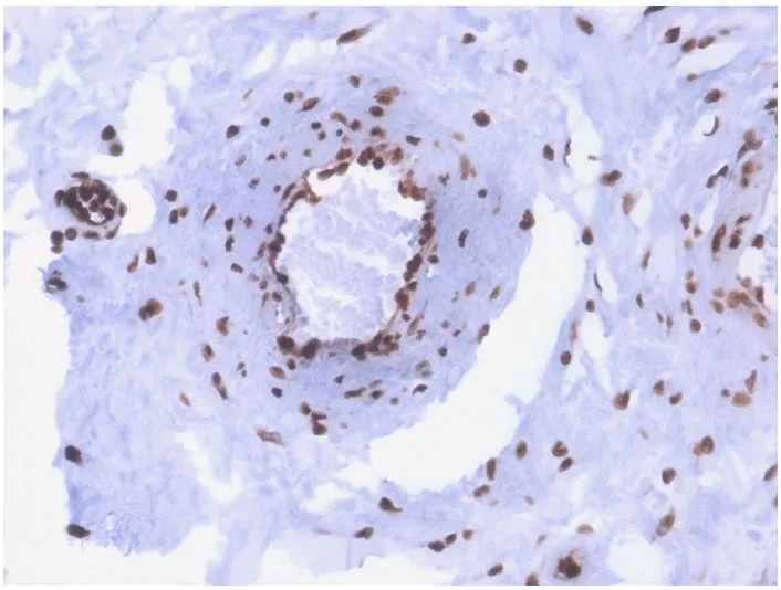 Immunohistochemistry (Formalin/PFA-fixed paraffin-embedded sections) - Anti-ds DNA antibody [rDSD/4565] - BSA and Azide free (AB273144)