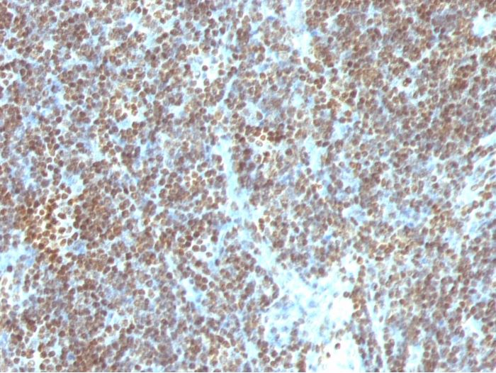 Immunohistochemistry (Formalin/PFA-fixed paraffin-embedded sections) - Anti-ds DNA antibody [SPM603] (AB270736), expandable thumbnail