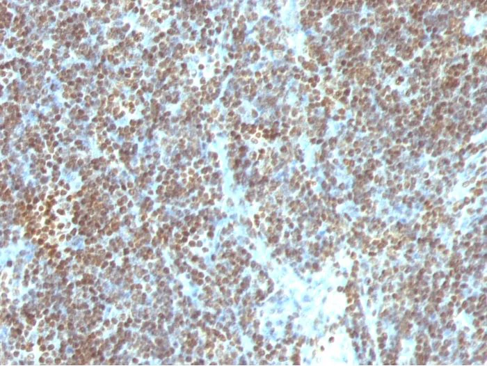 Immunohistochemistry (Formalin/PFA-fixed paraffin-embedded sections) - Anti-ds DNA antibody [SPM603] (AB270736)