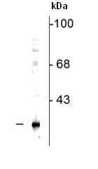 Western blot - Anti-DsbA L antibody (AB92819), expandable thumbnail