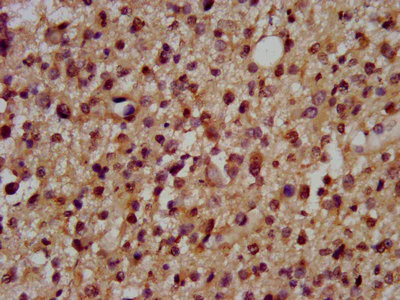 Immunohistochemistry (Formalin/PFA-fixed paraffin-embedded sections) - Anti-Dscam antibody (AB238113)