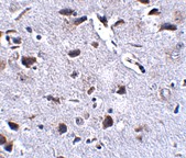 Immunohistochemistry (Formalin/PFA-fixed paraffin-embedded sections) - Anti-DSCR1L1 antibody (AB106543)