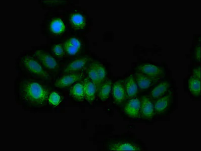 Immunocytochemistry/ Immunofluorescence - Anti-DSCR1L1 antibody (AB234856)