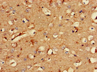Immunohistochemistry (Formalin/PFA-fixed paraffin-embedded sections) - Anti-DSCR1L1 antibody (AB234856)