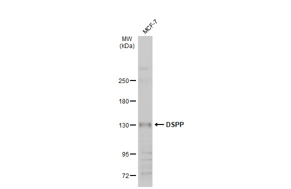 Western blot - Anti-DSPP antibody (AB272929)