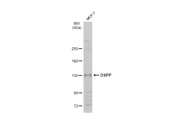 Western blot - Anti-DSPP antibody (AB272929)