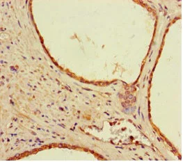 Immunohistochemistry (Formalin/PFA-fixed paraffin-embedded sections) - Anti-DSS1 antibody (AB238570)