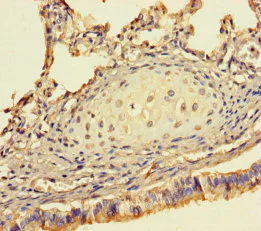 Immunohistochemistry (Formalin/PFA-fixed paraffin-embedded sections) - Anti-DSS1 antibody (AB238570)