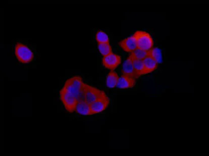 Immunocytochemistry/ Immunofluorescence - Anti-DSTN antibody [EPR15827(B)] (AB186754)
