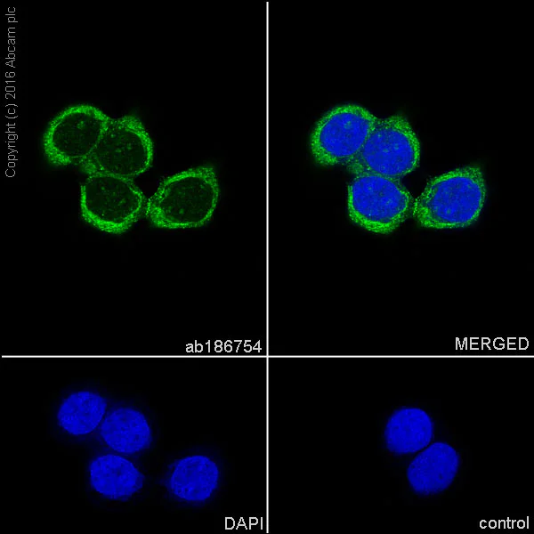 Immunocytochemistry/ Immunofluorescence - Anti-DSTN antibody [EPR15827(B)] (AB186754)