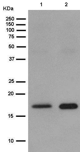 Western blot - Anti-DSTN antibody [EPR15827(B)] (AB186754)