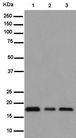 Western blot - Anti-DSTN antibody [EPR15827(B)] (AB186754)