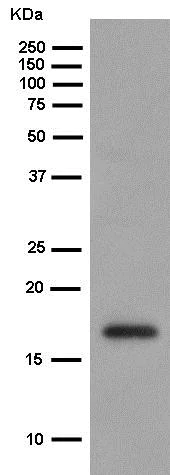 Western blot - Anti-DSTN antibody [EPR15827(B)] (AB186754)