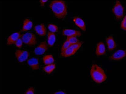 Immunocytochemistry/ Immunofluorescence - Anti-DSTN antibody [EPR15827(B)] - BSA and Azide free (AB240301)