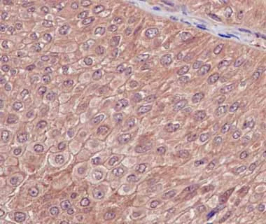 Immunohistochemistry (Formalin/PFA-fixed paraffin-embedded sections) - Anti-DSTN antibody [EPR15827(B)] - BSA and Azide free (AB240301)