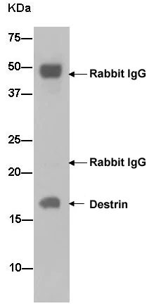 Immunoprecipitation - Anti-DSTN antibody [EPR15827(B)] - BSA and Azide free (AB240301)