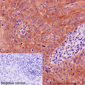 Immunohistochemistry (Formalin/PFA-fixed paraffin-embedded sections) - Anti-DSTN antibody [EPR15828] (AB192262)
