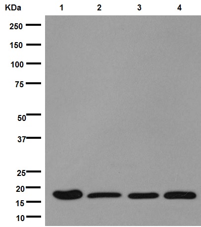 Western blot - Anti-DSTN antibody [EPR15828] (AB192262)