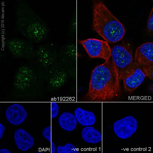 Immunocytochemistry/ Immunofluorescence - Anti-DSTN antibody [EPR15828] - BSA and Azide free (AB251129)